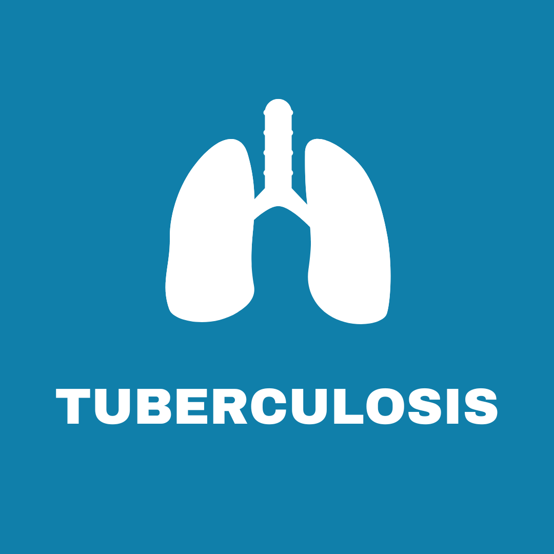 Tuberculosis